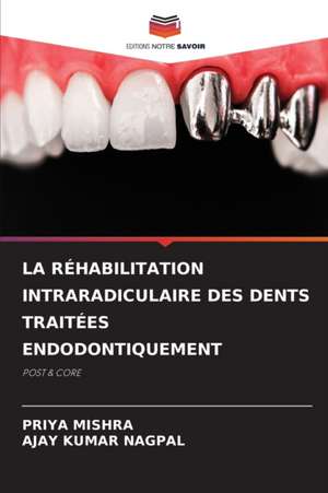 LA RÉHABILITATION INTRARADICULAIRE DES DENTS TRAITÉES ENDODONTIQUEMENT de Priya Mishra