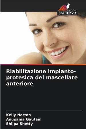 Riabilitazione implanto-protesica del mascellare anteriore de Kelly Norton