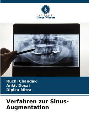 Verfahren zur Sinus-Augmentation de Ruchi Chandak