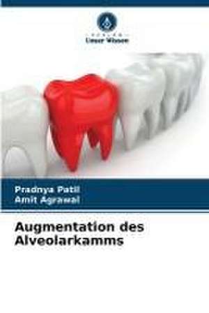 Augmentation des Alveolarkamms de Pradnya Patil