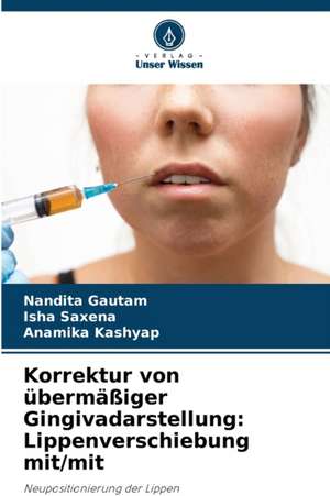 Korrektur von übermäßiger Gingivadarstellung: Lippenverschiebung mit/mit de Nandita Gautam