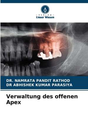 Verwaltung des offenen Apex de Namrata Pandit Rathod