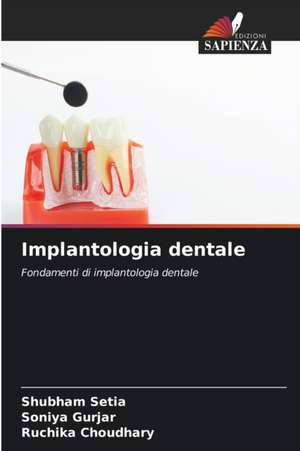 Implantologia dentale de Shubham Setia