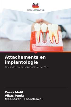 Attachements en implantologie de Paras Malik