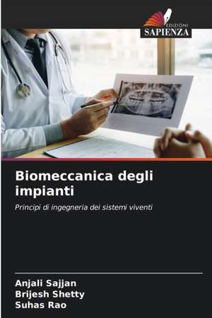 Biomeccanica degli impianti de Anjali Sajjan