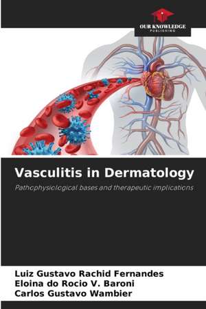 Vasculitis in Dermatology de Luiz Gustavo Rachid Fernandes