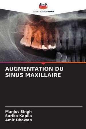 AUGMENTATION DU SINUS MAXILLAIRE de Manjot Singh