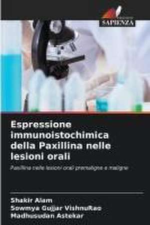 Espressione immunoistochimica della Paxillina nelle lesioni orali de Shakir Alam