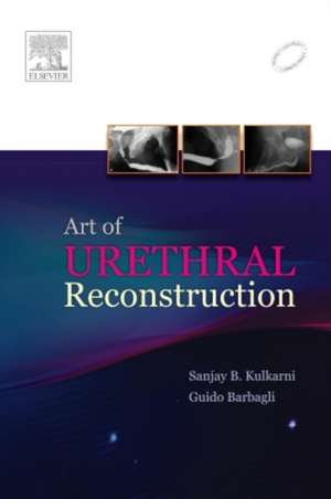 Art of Urethral Reconstruction de Sanjay Kulkarni