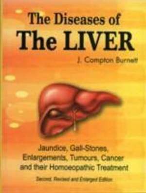 Diseases of the Liver de J Compton Burnett MD