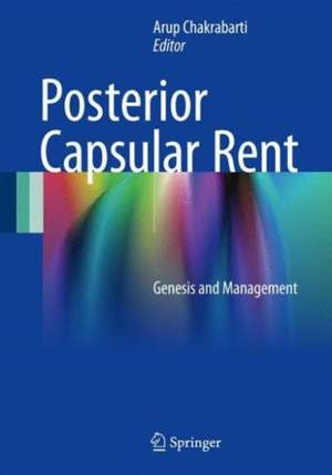 Posterior Capsular Rent: Genesis and Management de Arup Chakrabarti