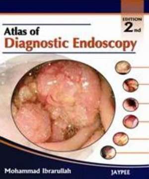 Atlas of Diagnostic Endoscopy, Second Edition de Mohammad Ibrarullah