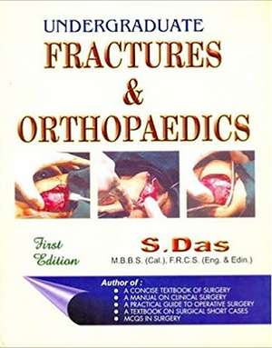 Undergraduate Fractures & Orthopaedics de S Das