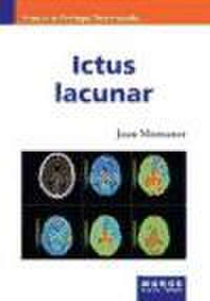 Ictus lacunar de Joan Montaner