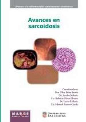 Avances en sarcoidosis de Ricard Cervera