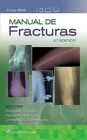 Manual de fracturas de Kenneth Egol MD