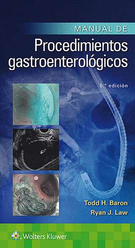 Manual de procedimientos gastroenterológicos de Todd Huntley Baron