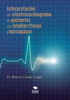 Interpretación del electrocardiograma de pacientes con bradiarritmias y marcapasos de Roberto Casola