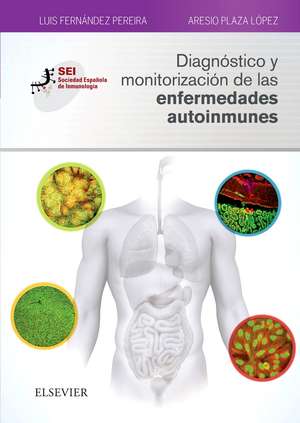 Diagnóstico y monitorización de las enfermedades autoinmunes de Luis Fernández Pereira