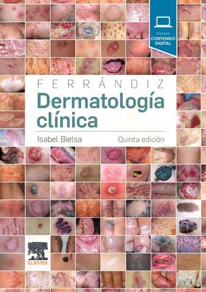 Dermatología clínica de Isabel Bielsa