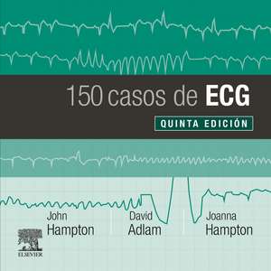 150 casos de ECG de John R. Hampton