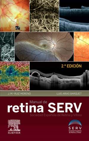 Manual de retina de Sociedad Española de Retina y Vítreo