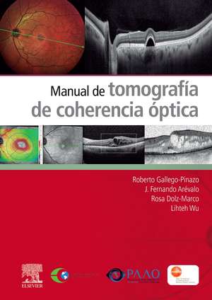 Manual de tomograf?a de coherencia ?ptica