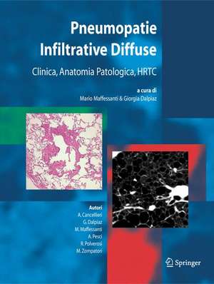 Pneumopatie Infiltrative Diffuse: Clinica, Anatomia Patologica, HRTC de M. Maffessanti