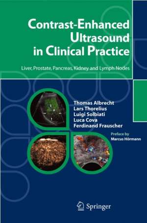 Contrast-Enhanced Ultrasound in Clinical Practice: Liver, Prostate, Pancreas, Kidney and Lymph Nodes de Thomas Albrecht