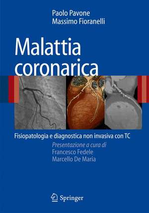 Malattia coronarica: Fisiopatologia e diagnostica non invasiva con TC de Paolo Pavone