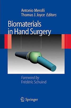 Biomaterials in Hand Surgery de Antonio Merolli