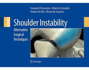 Shoulder Instability: Alternative Surgical Techniques de Giovanni Di Giacomo