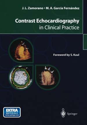 Contrast Echocardiography in Clinical Practice de Jose L. Zamorano