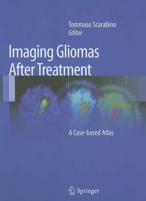 Imaging Gliomas After Treatment: A Case-based Atlas de Tommaso Scarabino