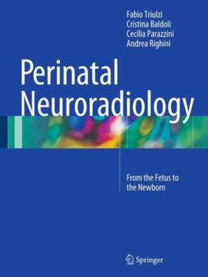 Perinatal Neuroradiology: From the Fetus to the Newborn de Fabio Triulzi