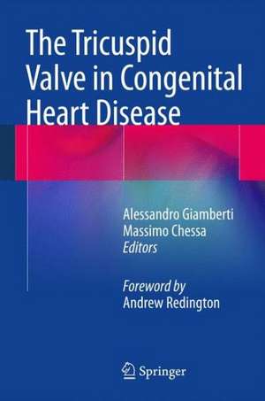 The Tricuspid Valve in Congenital Heart Disease de Alessandro Giamberti