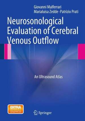 Neurosonological Evaluation of Cerebral Venous Outflow: An Ultrasound Atlas de Giovanni Malferrari