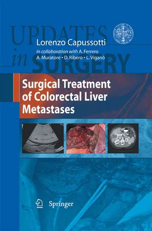 Surgical Treatment of Colorectal Liver Metastases de Lorenzo Capussotti