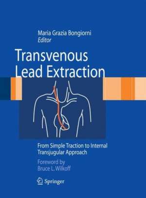 Transvenous Lead Extraction: From Simple Traction to Internal Transjugular Approach de Maria Grazia Bongiorni