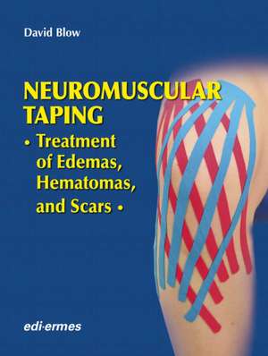 NeuroMuscular Taping: Treatment of Edemas, Hematomas, and Scars de David Blow