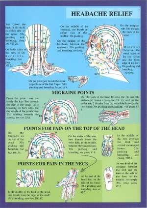 Acupuncture for the Head -- A4 de Jan van Baarle