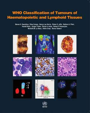 Who Classification of Tumours of Haematopoietic and Lymphoid Tissues [Op] de World Health Organization