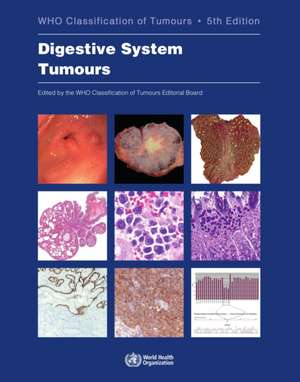 Digestive System Tumours [Op] de Who Classification of Tumours Editorial Board