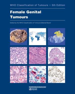 Female Genital Tumours de Who Classification of Tumours Editorial Board