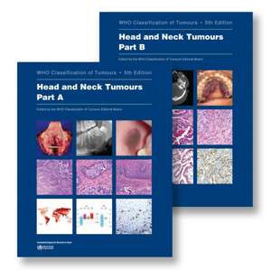 Head and Neck Tumours de Who Classification of Tumours Editorial Board