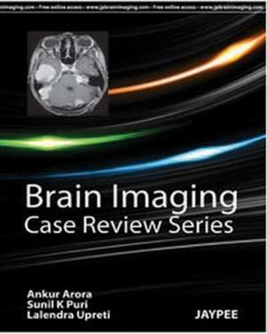 Brain Imaging: Case Review Series de Ankur Arora