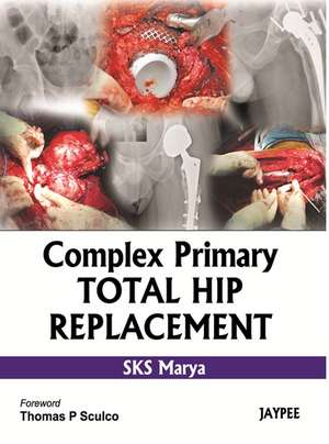 Complex Primary Total Hip Replacement de S.K.S. Marya