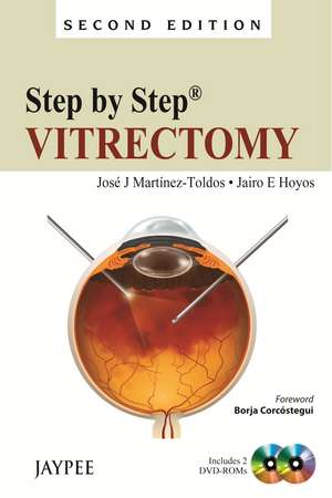 Step by Step: Vitrectomy de Jose J Martinez-Toldos