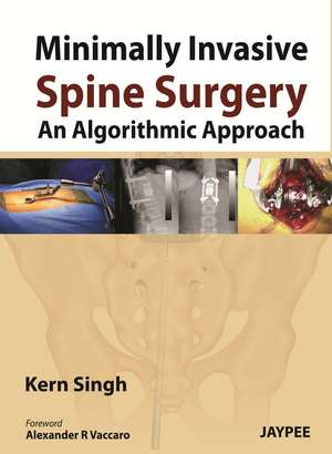 Minimally Invasive Spine Surgery: An Algorithmic Approach de Kern Singh