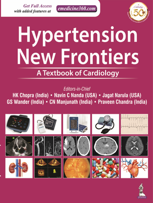 Hypertension: New Frontiers: A Textbook of Cardiology de HK Chopra